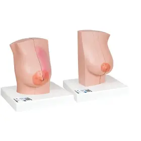3b Scientific 087757313607 L56 Model Of The Female Breast - Smart Anatomy